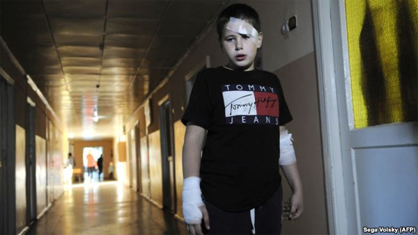 10-річний хлопчик, який вижив після вибуху, Горлівка, 30 вересня 2018 року