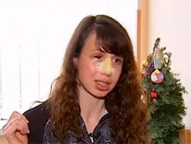 Чорновол каже, що пам’ятає лише одного нападника Чорновол каже, що пам’ятає лише одного нападника